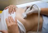 Ultrazvuk abdomena, ultrazvuk trbuha