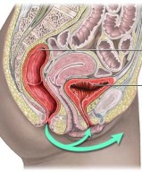 Putevi širenja infekcije iz anusa debelog crijeva u mokraćnu cijev, žene