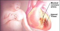 pritisak u prsima štitnjača hipertenzije i fervex